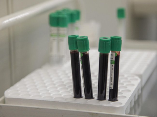 Мутации минус: названы случаи, когда достижения генетики спасали жизнь больным - «Новости»